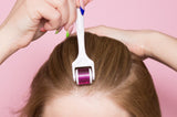 Why You Should Never Try Microneedling for Hair Loss at Home